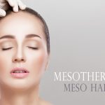 مزوتراپی ، برای پیشگیری و درمان ریزش مو